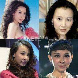 娱乐圈谁整容了